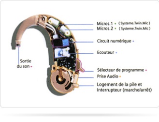 les composants d'un appareillage auditif